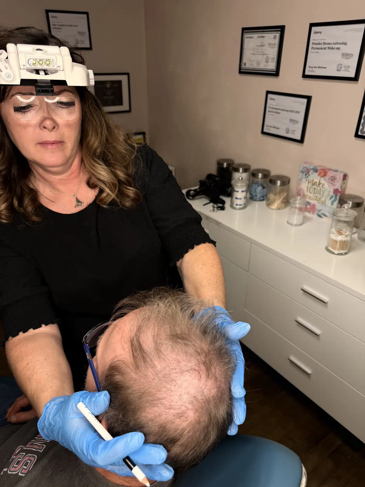 Tracy mapping a new hairline in pencil on a client's head, wearing a magnifying headlamp